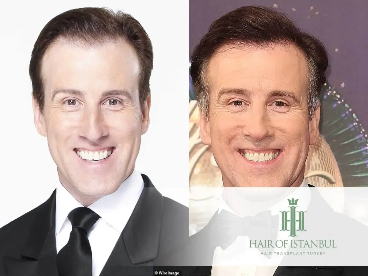 Anton du Beke